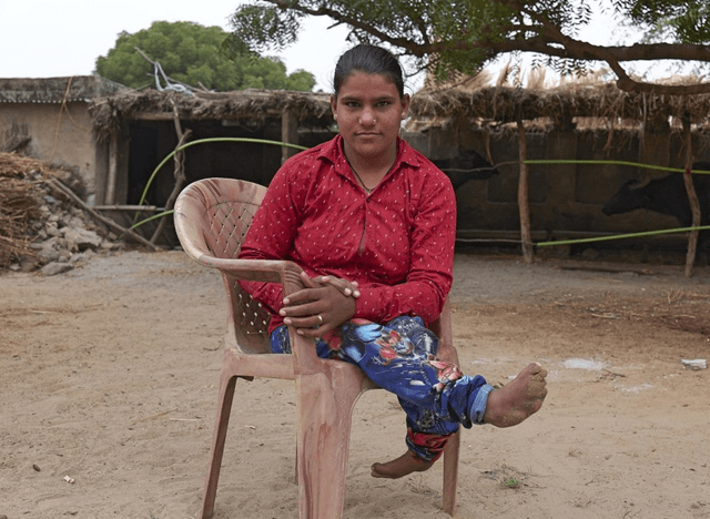 Support for People with Disabilities